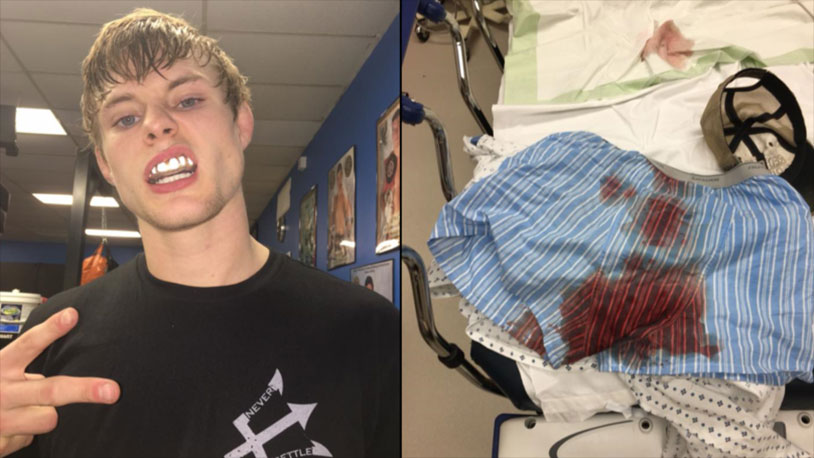 Another MMA Fighter Really Screwed Up His Balls